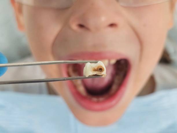Best Emergency Cosmetic Dentistry (e.g., broken veneers) in Canutillo, TX