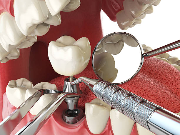 Best Emergency Denture Repair in Canutillo, TX