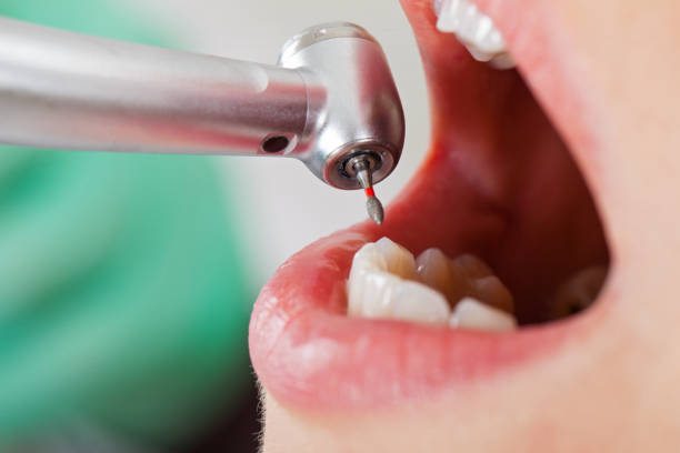 Best Walk-In Emergency Dental Services in Canutillo, TX
